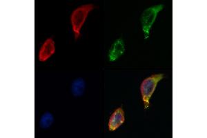 ABIN6264260 and ABIN6268782 staining Hela by IF/ICC. (PKM2 antibody  (Internal Region))