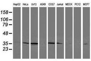 Image no. 2 for anti-Cyclin-Dependent Kinase 2 (CDK2) antibody (ABIN1497399) (CDK2 antibody)