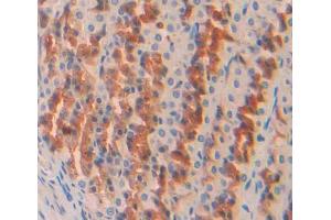 Used in DAB staining on fromalin fixed paraffin- embedded stomach tissue (OS9 antibody  (AA 465-666))