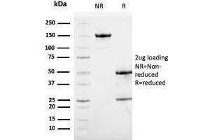SDS-PAGE Analysis Purified Calprotectin Mouse Monoclonal Antibody (S100A9/1075). (S100A9 antibody)