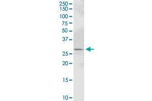 PYCR1 MaxPab polyclonal antibody. (PYCR1 antibody  (AA 1-319))