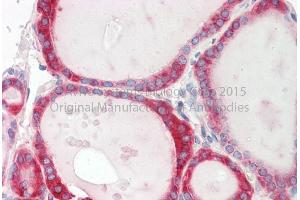 Rabbit Anti-CALR Antibody Catalog Number: ARP58123 Formalin Fixed Paraffin Embedded Tissue: Human Adult Thyroid  Observed Staining: Cytoplasm in hepatocytes Primary Antibody Concentration: 1:600 Secondary Antibody: Donkey anti-Rabbit-Cy3 Secondary Antibody Concentration: 1:200 Magnification: 20X Exposure Time: 0. (Calreticulin antibody  (N-Term))