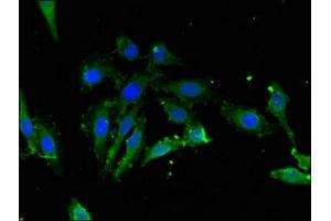 Immunofluorescent analysis of Hela cells using ABIN7157798 at dilution of 1:100 and Alexa Fluor 488-congugated AffiniPure Goat Anti-Rabbit IgG(H+L) (Lactate Dehydrogenase C antibody  (AA 2-332))
