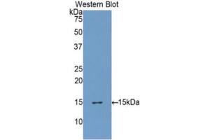 WB of Protein Standard: different control antibodies against Highly purified E. (FURIN ELISA Kit)