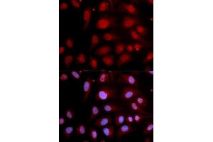 Immunofluorescence analysis of U2OS cell using POLB antibody. (POLB antibody  (AA 1-335))