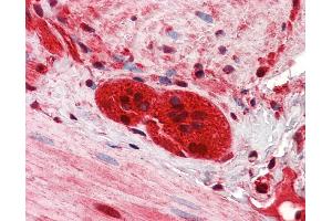 IHC Information: Paraffin embedded small intestine, myenteric plexus tissue, tested with an antibody dilution of 2. (ZEB2 antibody  (Middle Region))