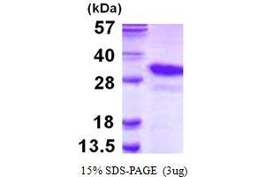 SDS-PAGE (SDS) image for Proteasome Subunit alpha 8 (PSMA8) (AA 1-250) protein (His tag) (ABIN667988)