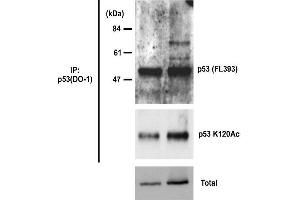 Western Blotting (WB) image for anti-Tumor Protein P53 (TP53) (acLys315) antibody (ABIN3201007) (p53 antibody  (acLys315))