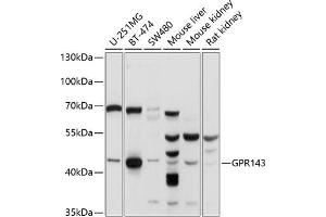 Western blot analysis of extracts of various cell lines, using GPR143 antibody (ABIN6131675, ABIN6141346, ABIN6141347 and ABIN6214863) at 1:1000 dilution. (GPR143 antibody  (AA 314-404))
