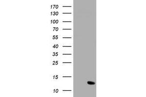 Image no. 1 for anti-Chromosome 17 Open Reading Frame 37 (C17orf37) antibody (ABIN1501779) (C17orf37 antibody)