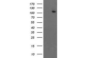 HEK293T cells were transfected with the pCMV6-ENTRY control (Left lane) or pCMV6-ENTRY ERCC4 (Right lane) cDNA for 48 hrs and lysed. (ERCC4 antibody)