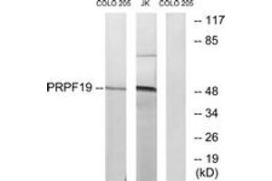 Western blot analysis of extracts from COLO/Jurkat cells, using PRPF19 Antibody.