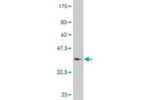 Western Blot detection against Immunogen (37. (B4GALT5 antibody  (AA 48-151))
