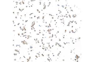 Immunocytochemistry (ICC) image for anti-Epidermal Growth Factor Receptor (EGFR) (C-Term) antibody (ABIN7795642) (Recombinant EGFR antibody  (C-Term))