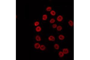 ABIN6274692 staining K562 by IF/ICC. (MLH1 antibody  (Internal Region))
