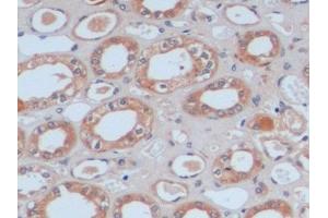 Detection of FN in Human Kidney Tissue using Polyclonal Antibody to Fibronectin (FN) (Fibronectin antibody  (AA 1998-2106))