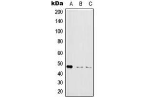 Western Blotting (WB) image for anti-Inhibitor of kappa Light Polypeptide Gene Enhancer in B-Cells, Kinase gamma (IKBKG) (N-Term), (pSer31) antibody (ABIN7297394)