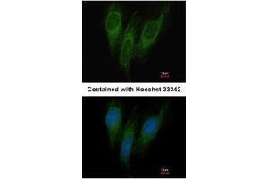 ICC/IF Image Immunofluorescence analysis of methanol-fixed HeLa, using DNAJC1, antibody at 1:200 dilution. (DNAJC1 antibody  (Center))