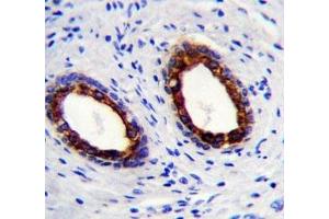 Immunohistochemistry (IHC) image for anti-Keratin 18 (KRT18) (AA 401-430) antibody (ABIN3031537)