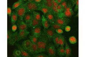 IF analysis of HLTF using anti-HLTF antibody (ABIN4886619) and anti-Tubulin Alpha antibody (ABIN7600339). (HLTF antibody  (AA 911-1009))