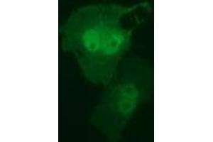 Anti-RIT2 mouse monoclonal antibody (ABIN2453598) immunofluorescent staining of COS7 cells transiently transfected by pCMV6-ENTRY RIT2 (RC205367). (RIT2 antibody)