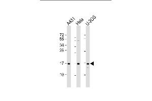 All lanes : Anti-RPLP1 Antibody (N-Term) at 1:2000 dilution Lane 1: A431 whole cell lysate Lane 2: Hela whole cell lysate Lane 3: U-2OS whole cell lysate Lysates/proteins at 20 μg per lane. (RPLP1 antibody  (AA 18-49))