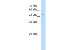 Western Blotting (WB) image for anti-STEAP Family Member 3, Metalloreductase (STEAP3) antibody (ABIN2462709) (STEAP3 antibody)