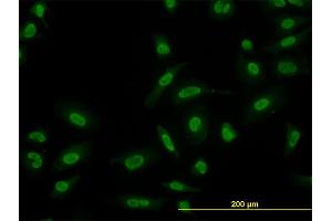 Immunofluorescence of monoclonal antibody to SMAD5 on HeLa cell. (SMAD5 antibody  (AA 105-182))