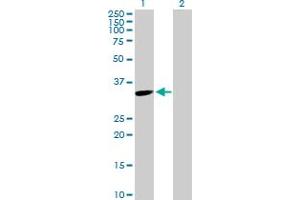 Western Blot analysis of TYMS expression in transfected 293T cell line by TYMS MaxPab polyclonal antibody. (TYMS antibody  (AA 1-313))