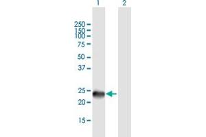 Western Blot analysis of SSX9 expression in transfected 293T cell line by SSX9 MaxPab polyclonal antibody. (SSX9 antibody  (AA 1-188))