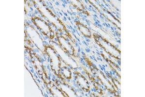 Immunohistochemistry of paraffin-embedded mouse kidney using CTNNA1 antibody. (CTNNA1 antibody  (AA 637-906))