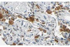Image no. 2 for anti-Fanconi Anemia Complementation Group G (FANCG) (AA 1-12), (N-Term) antibody (ABIN401267) (FANCG antibody  (N-Term))
