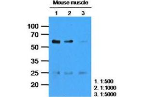 The extracts of Mouse muscle (35ug) were resolved by SDS-PAGE, transferred to PVDF membrane and probed with anti-human CASQ2 (1:1000). (CASQ2 antibody)
