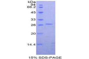SDS-PAGE analysis of Rat GATA Binding Protein 4 Protein. (GATA4 Protein)