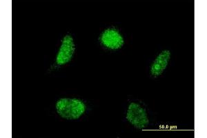 Immunofluorescence of monoclonal antibody to LHX4 on HeLa cell.