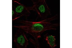 Immunofluorescence analysis of NTERA-2 cells using SIRT1 mouse mAb (green). (SIRT1 antibody)