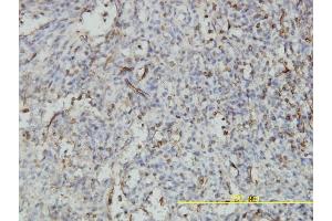 Immunoperoxidase of monoclonal antibody to NUCB1 on formalin-fixed paraffin-embedded human spleen tissue. (Nucleobindin 1 antibody  (AA 28-461))