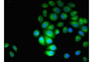 Immunofluorescent analysis of A549 cells using ABIN7143927 at dilution of 1:100 and Alexa Fluor 488-congugated AffiniPure Goat Anti-Rabbit IgG(H+L) (Parvin alpha antibody  (AA 2-94))