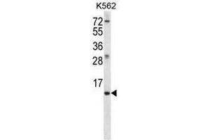 MEIG1 Antibody (Center) western blot analysis in K562 cell line lysates (35µg/lane). (MEIG1 antibody  (Middle Region))