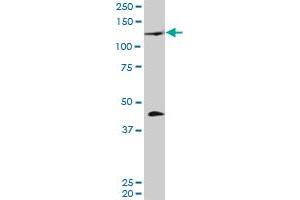 PRDM1 monoclonal antibody (M01), clone 2B10. (PRDM1 antibody  (AA 1-109))