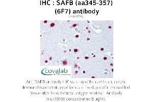 Image no. 1 for anti-Scaffold Attachment Factor B (SAFB) (AA 345-357) antibody (ABIN1723104) (SAFB antibody  (AA 345-357))