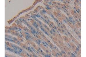 Detection of TMEM27 in Mouse Stomach Tissue using Polyclonal Antibody to Transmembrane Protein 27 (TMEM27) (TMEM27 antibody  (AA 12-222))