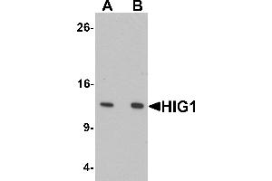 Western blot analysis of HIG1 in 293 cell lysate with HIG1 antibody at at (A) 0.