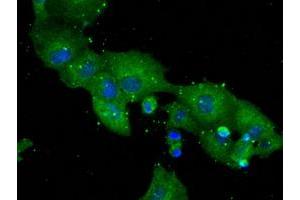 Anti-DPP4 mouse monoclonal antibody (ABIN2452961) immunofluorescent staining of COS7 cells transiently transfected by pCMV6-ENTRY DPP4 (RC209466). (DPP4 antibody)