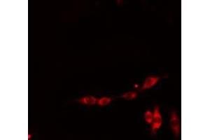 ABIN6278629 staining HepG2 cells by IF/ICC. (RIOK3 antibody  (Internal Region))
