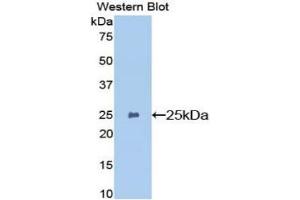 Detection of Recombinant GSTp, Mouse using Polyclonal Antibody to Glutathione S Transferase Pi (GSTp) (GSTP1 antibody  (AA 1-210))