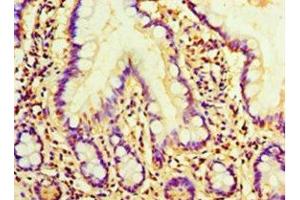 Immunohistochemistry (IHC) image for anti-Anti-Mullerian Hormone (AMH) (AA 26-560) antibody (ABIN7160302)