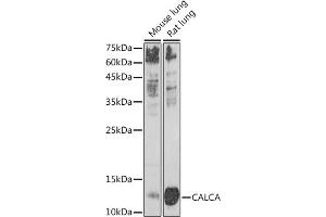Western blot analysis of extracts of various cell lines, using CALCA antibody (ABIN7266005) at 1:1000 dilution. (CGRP antibody  (AA 1-141))