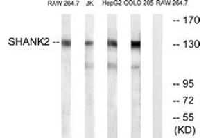 Western blot analysis of extracts from RAW264. (SHANK2 antibody  (AA 331-380))