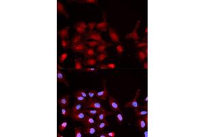 Immunofluorescence analysis of MCF7 cell using Phospho-ABL1-Y245 antibody. (ABL1 antibody  (pTyr245))